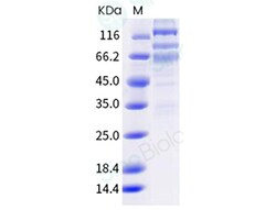 Sino Biological Protein SARS-CoV-2 Spike 100ug, Quantity: Each of 1