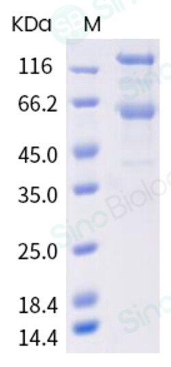 Sino Biological SARS-CoV-2 (2019-nCoV) Spike S1+S2 ECD (HV69-70 deletion,