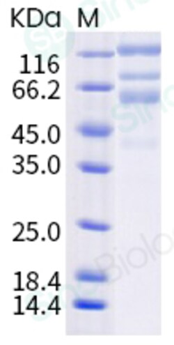 Sino Biological SARS-CoV-2 (2019-nCoV) Spike S1+S2 (L18F, D80A, D215G,