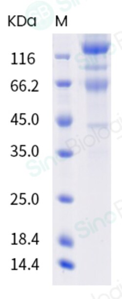 Sino Biological SARS-CoV-2 (2019-nCoV) Spike S1+S2 (L18F, D80A, D215G,