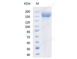 Sino Biological SARS-CoV-2 B.1.617.2 Spike S1+S2 trimer Protein (ECD, His