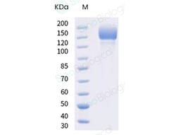 Sino Biological SARS-CoV-2 B.1.617.1 Spike S1+S2 trimer Protein (ECD, His