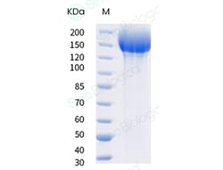 Sino Biological SARS-CoV-2 B.1.351 Spike S1+S2 trimer Protein (ECD, His
