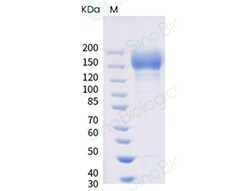 Sino Biological SARS-CoV-2 (AY.1) Spike S1+S2 trimer Protein (ECD, His