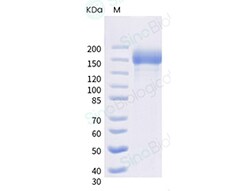 Sino Biological SARS-CoV-2 (AY.3) Spike S1+S2 trimer Protein (ECD, His