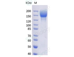 Sino Biological SARS-CoV-2 (P.1) Spike S1+S2 trimer Protein (ECD, His tag)