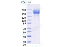 Sino Biological SARS-CoV-2 (C.37) Spike S1+S2 trimer Protein ( ECD, His