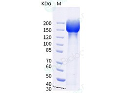 Sino Biological SARS-CoV-2 (BA.1.1) Spike S1+S2 trimer Protein (ECD, His