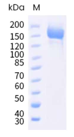 Sino Biological SARS-CoV-2 (BA.4/BA.5) Spike S1+S2 trimer Protein (ECD,
