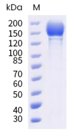 Sino Biological SARS-CoV-2 (BA.2.12.1) Spike S1+S2 trimer Protein (ECD,