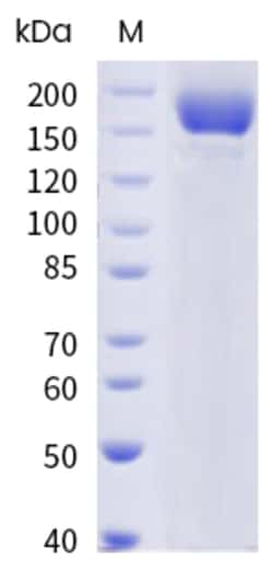 Sino Biological SARS-CoV-2 (BA.2.75) Spike S1+S2 trimer Protein (ECD, His