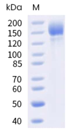 Sino Biological SARS-CoV-2 Spike Protein 100ug (Sino Biological), Quantity: