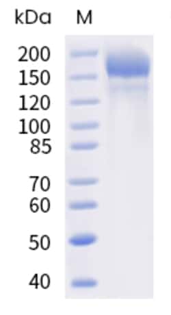 Sino Biological SARS-CoV-2 Spike Protein 100ug (Sino Biological), Quantity: