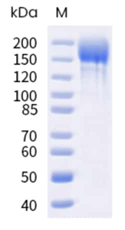Sino Biological SARS-CoV-2 Spike Protein 100ug (Sino Biological), Quantity: