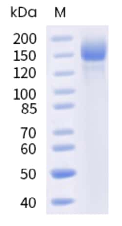 Sino Biological SARS-CoV-2 Spike Protein 100ug (Sino Biological), Quantity: