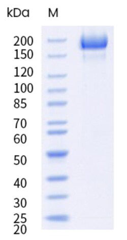 Sino Biological&nbsp;SARS-COV-2 NB.1.8.1 (Omicron) Spike S1+S2 trimer Protein (His Tag) (MALS-verified) 100
