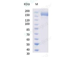 Sino Biological SARS-CoV-2 B.1.618 Spike S1+S2 trimer Protein (ECD, His