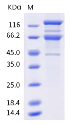 Sino Biological SARS-CoV-2 Spike Protein 20ug (Sino Biological), Quantity: