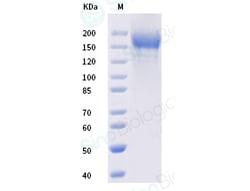 Sino Biological SARS-CoV-2 (B.1.617.2) Spike S1+S2 trimer Protein (ECD,