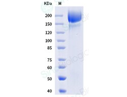 Sino Biological Protein SARS-CoV-2 Spike 20ug, Quantity: Each of 1