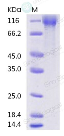 Sino Biological SARS-CoV-2 (2019-nCoV) Spike S1-His Recombinant Protein,