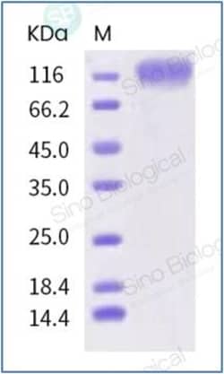 Sino Biological SARS-CoV-2 (2019-nCoV) Spike S1-His Recombinant Protein