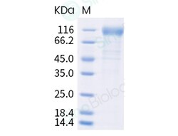 Sino Biological SARS-CoV-2 Spike S1 (E154K, L452R, E484Q, D614G, P681R)