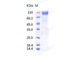 Sino Biological SARS-CoV-2 Spike S1 (H49Y, YH145-146 deletion, E484K, D614G)