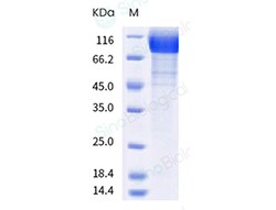 Sino Biological SARS-CoV-2 Spike S1 (T19R, G142D, L452R, E484Q, D614G,
