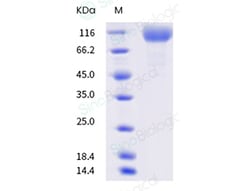 Sino Biological SARS-CoV-2 Spike S1 (L5F, T95I, D253G, S477N, E484K, D614G)