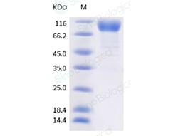 Sino Biological SARS-CoV-2 Spike S1 (Q52R, A67V, 69-70 deletion, 144 deletion,