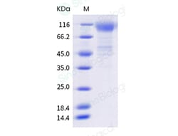 Sino Biological SARS-CoV-2 Spike S1 (G75V, T76I, R246N, 247 deletion, 253