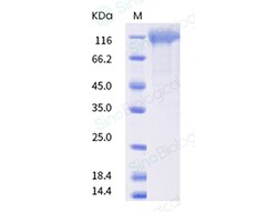 Sino Biological SARS-CoV-2 Spike S1 (G75V, T76I, (RSYLTPG246-252)deletion,