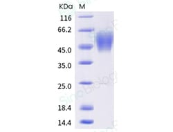Sino Biological SARS-CoV-2 Spike S1 NTD (T19R, T95I, G142D, 156-157 deletion,