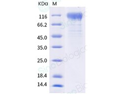 Sino Biological SARS-CoV-2 Spike S1 (T95I, Y144S, Y145N, R346K, E484K,