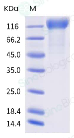 Sino Biological SARS-CoV-2 (2019-nCoV) Spike S1(A222V, D614G)-His Recombinant