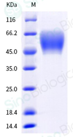 Sino Biological SARS-CoV-2 B.1.1.529 (Omicron) Spike S1 NTD Protein (His