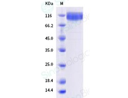 Sino Biological SARS-CoV-2 (B.1.1.529 sublineage BA.2) Spike S1 Protein