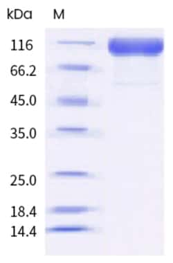 Sino Biological SARS-CoV-2 (BA.2.12.1) Spike S1 Protein (His Tag) (HPLC-verified)