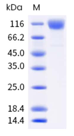 Sino Biological SARS-CoV-2 (BA.4/BA.5) Spike S1 Protein (His Tag) (HPLC-verified)