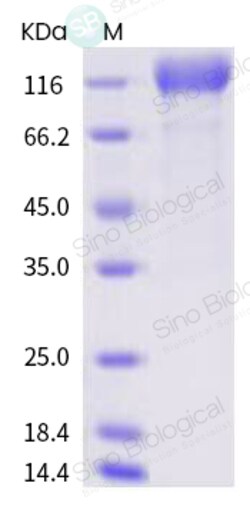Sino Biological SARS-CoV-2 (2019-nCoV) Spike S1-AVI & His Recombinant Protein,