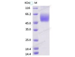 Sino Biological SARS-CoV-2 (2019-nCoV) Spike S1 NTD-His & AVI Recombinant