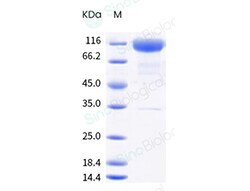 Sino Biological Protein SARS-CoV-2 Spike 20ug, Quantity: Each of 1
