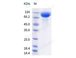 Sino Biological SARS-CoV-2 Spike S1 ((157-158) deletion, T19R, G142D, E156G,