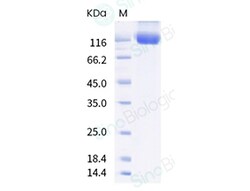 Sino Biological SARS-CoV-2 Spike S1 (T19R, G142D, L452R, E484Q, D614G,