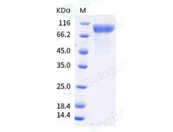 Sino Biological Protein SARS-CoV-2 Spike 20ug, Quantity: Each of 1