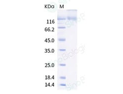 Sino Biological SARS-CoV-2 Spike S1 ((LAL242-244)deletion, L18F, D80A,
