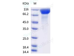 Sino Biological SARS-CoV-2 Spike S1 (L18F, T20N, P26S, D138Y, R190S, K417T,