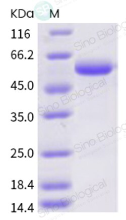Sino Biological SARS-CoV-2 (2019-nCoV) Spike RBD-Fc Recombinant Protein