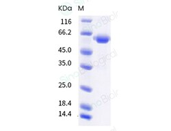 Sino Biological SARS-CoV-2 Spike RBD (L452R, T478K) Protein (Fc Tag), Quantity: